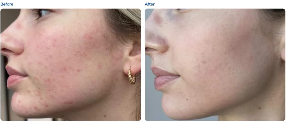 DERMA M Dr Lukarova 3
