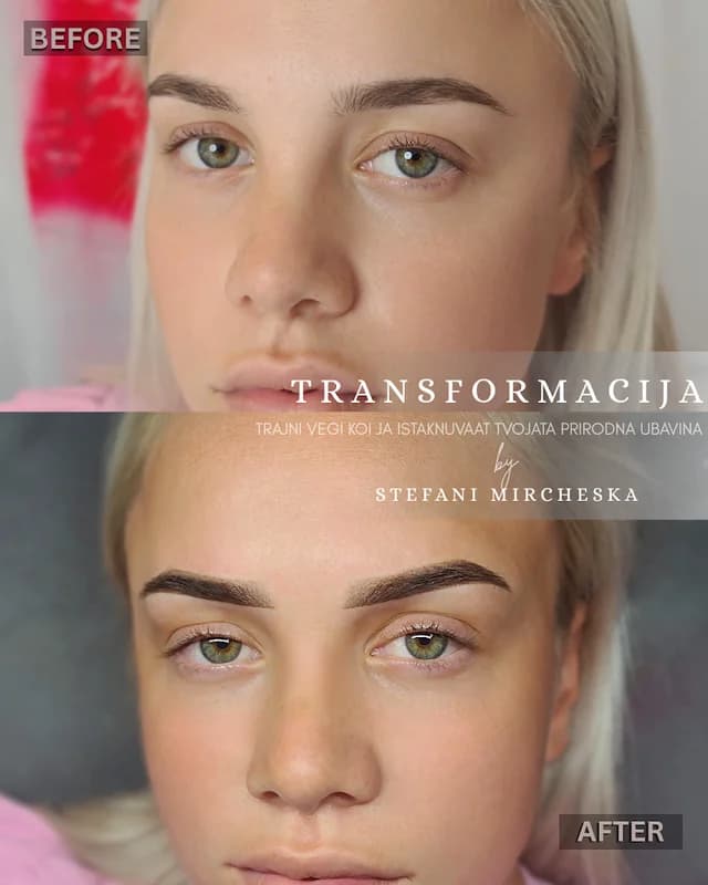 Beauty beyond