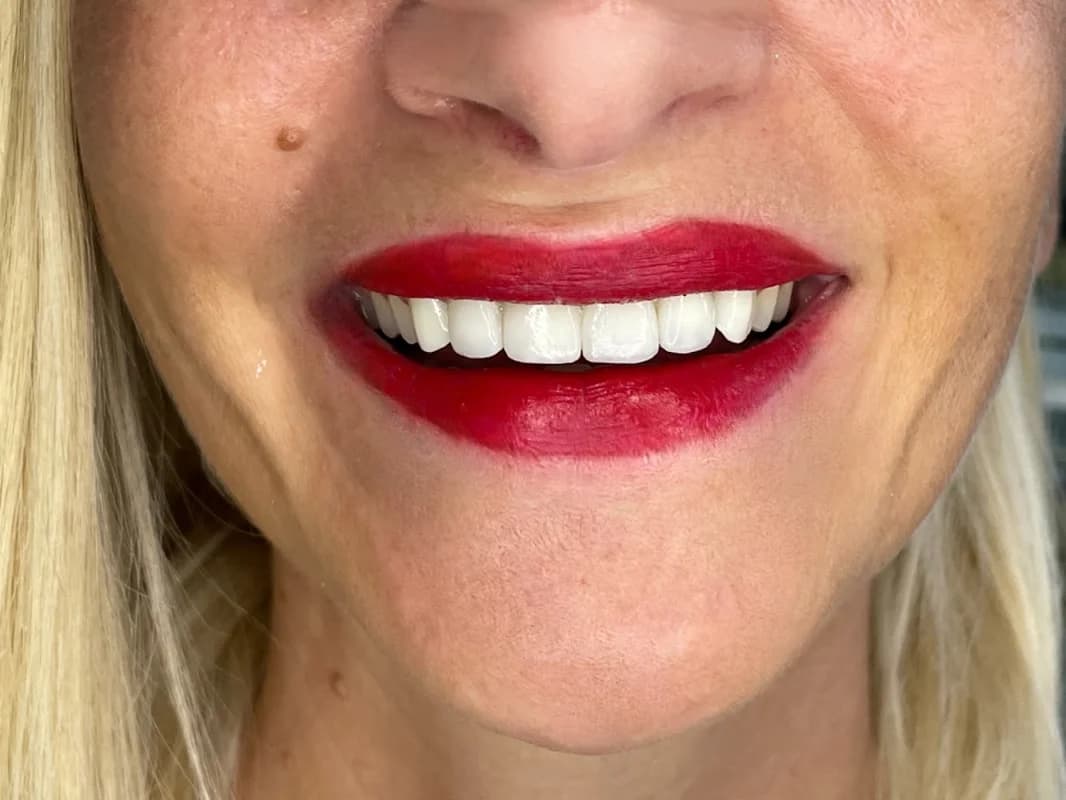 Dentist Protetika Petkovi 1