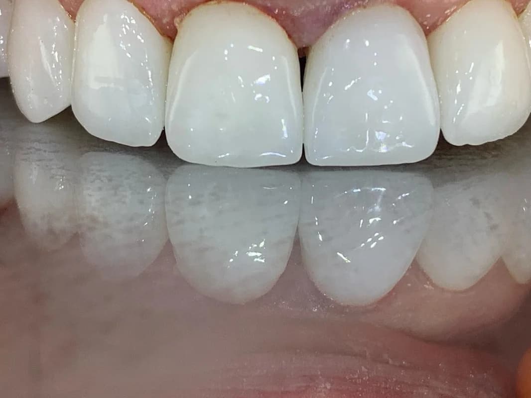 Mersiha Dental