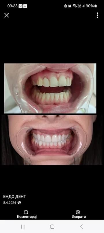 Endo Dent