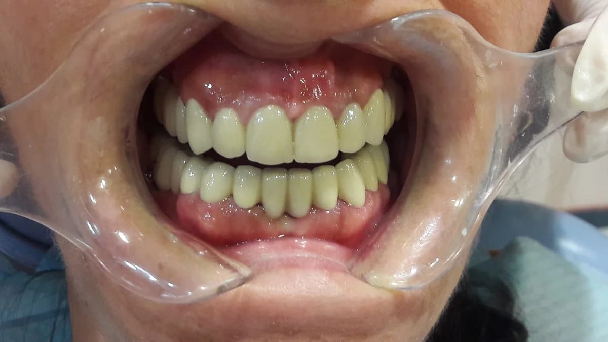 Dental Care Dr. Lukanoski